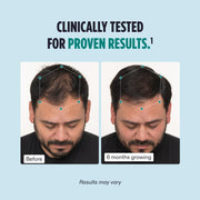 Nutrafol Men's Hair Growth Supplements