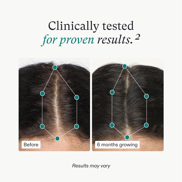 Nutrafol Women's Hair Growth Supplements,